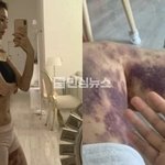 병원이랑 13억 소송 이겼다 <b>법원</b>이 병원측 11가지 주장 다 기각함