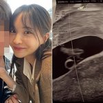 "낳든 말든 호적 안 돼"… '임신→스토킹 고소' 서민재가 밝힌...