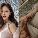 피멍→병원에 13억 승소..前남편은 200만원 <b>배상</b> [스타이슈]