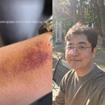 '<b>K</b>대 <b>의료</b>경영학 출신' 최동석, 병원 방문 후 "이것밖에 안...