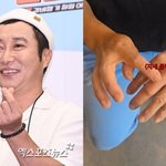 김병만, <b>지네</b> 물림 사고 당했다…퉁퉁 부은 손에 "병원 가라'...