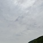 5년전에 교정했는데 아직 교정기 안뗌...