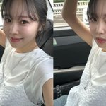 '박성광 아내' 이솔이, 암투병 고백 후 "턱선 마음에 들어"