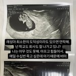 [댓글부탁해] '임신' 서민재, 남친에 연락 요청 "수십번 죽고...