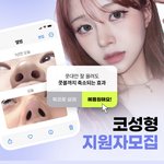 아니 코<b>성형</b>하면 무조건 콧구멍 이렇게 돼?