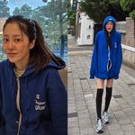  다리 <b>굵기</b> 무슨 일? 위태로울 정도…이러니 휘청거리지 [DA]