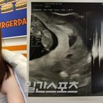 ‘임신’ 서민재, 또 남친 저격+호소…”아기 때문에 버텨, 연락하길”