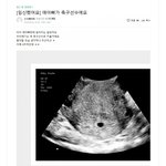 [어케생각해] 작년 맘카페에 올라왔다가 빛삭된 게<b>시물</b>