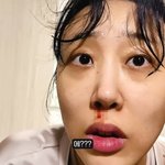 '쌍둥이 임신' 임라라, 유혈 사태…"매일 지옥 같은데 이게 맞냐"...