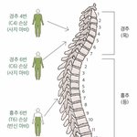 사지마비 환자 치료하는 방법.jpg
