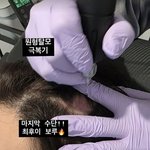 <b>이솔</b>이 암 극복 후 또다시 병원行…박성광, 훤히 드러난 원형탈모
