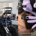 '이솔이' 박성광, 원형 탈모 극복한다.."<b>최후</b>의 보루"