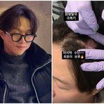 <b>이솔</b>이 여성암 투병→박성광 원형탈모 치료 “마지막 수단”