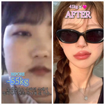 “못생겼다고 욕하던 그놈”… -55kg 감량 후 달라진 연애, 벤츠...