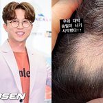 ‘이솔이’ 박성광, 원형탈모 치료받더니 “<b>솜털</b>이 나기 시작했다”