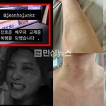 뮤지컬배우 전호준 연인이 폭로함  연애하다 성병 옮기고 유산시키고...