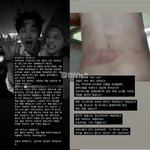 뮤지컬배우 전호준 여친 헤르페스성병<b>전염</b>, 금전요구, 폭행 논란반박함...