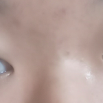 [댓글부탁해] 제 눈 성형 하려고합니다.. 욕 절대 xxxx이렇게...