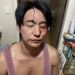 전호준, 피투성이 얼굴로 <b>반박</b>…전여친 폭행 주장에 사진+음성 공개...