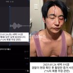 전호준이 전여친의 성병감염 ,폭행,금전 주장에 자기 피투성이 얼굴사진이랑...