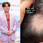 ‘이솔이’ 박성광, 원형탈모 치료 중 기적적 근황 “<b>솜털</b> 나기 시작했다”