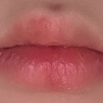 [댓글부탁해] 나 엄마가 입꼬리 <b>수술</b>시켜준다는데 봐줘
