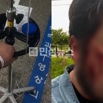 김대호 말라리아 걸려서 고열에 신장까지 손상됐다는데 어떡하냐;;
