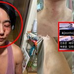 전호준이 전 여친 상처가 전남친한테 폭행당한 거라고 인스타에 입장문...