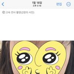 [댓글부탁해] <b>사각</b>턱 보톡스 효과 있음 (사진 o)