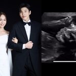임정희<b>발레리노</b> 김희현, 결혼 1년 7개월만 임신 "아기 천사 찾아와"