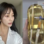 동안 비결은 줄기세포 주사?…"망가진 피부 살려줘" [<b>MD</b>스타]