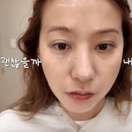 눈 밑 상태 어떻기에..지방 <b>재배치</b> 수술 고민 "몇 년째 결정...