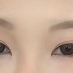 [댓글부탁해] 이정도면 쌍수 몇 <b>미리</b>?