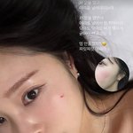 '암투병 고백' 이솔이, 갈비뼈로 걱정 자아내더니…결국 피 봤다