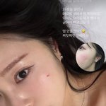 '암투병' 이솔이, 얼굴 <b>부상</b> "닦아도 피 맺혀"