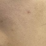 [댓글부탁해] 하 <b>건성</b>최악인거같아 모공인거맞지이거