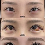 <b>뒷밑</b>트임 이게 가능한거임?