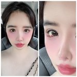 “눈 속 핏빛 번짐?” 박봄, 드라이브 중 근황에 팬들 ‘걱정 반...