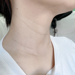 [도와주세요] 이 나이에 목주름 이거 맞냐