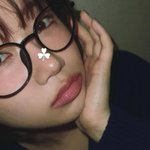 최유정, 꼬리뼈 골절 부상에도 사랑스럽네…통증 싹 잊을 미모 [RE:스타]