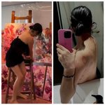 이혜영, 등 위에 그린 그림…부항도 예술로 만드는 그녀