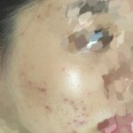 [댓글부탁해] 약혐)나 피부 많이 좋아졌지