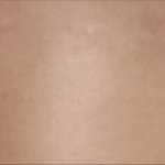 성형잘<b>알들</b>아 이런 눈은 어떡함?