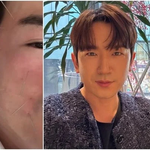 "신화 이민우, 26억 뜯긴 뒤 <b>구안와사</b>로 얼굴도 삶도 무너져....