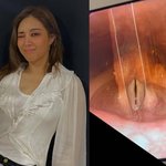 투어" 옥주현, 내시경 후 쓸어내린 가슴…"후유증 <b>염려</b>해"