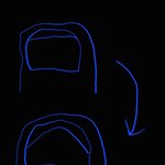 너네 엄지발톱 <b>옆쪽</b> 들려본적 있냐