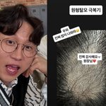 [댓글부탁해] '이솔이' 박성광, "<b>우와</b> 진짜 듬성듬성 많아" 탈모...