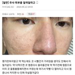 [댓글부탁해] <b>홍조</b>가 고민인 남성