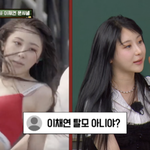 25세 이채연, <b>모발</b>이식 했다..“워터밤서 탈모 충격받아 3521모...