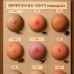 [웃픽] 뭔가 이상한 <b>벌레</b>마다 불렸을때 상처